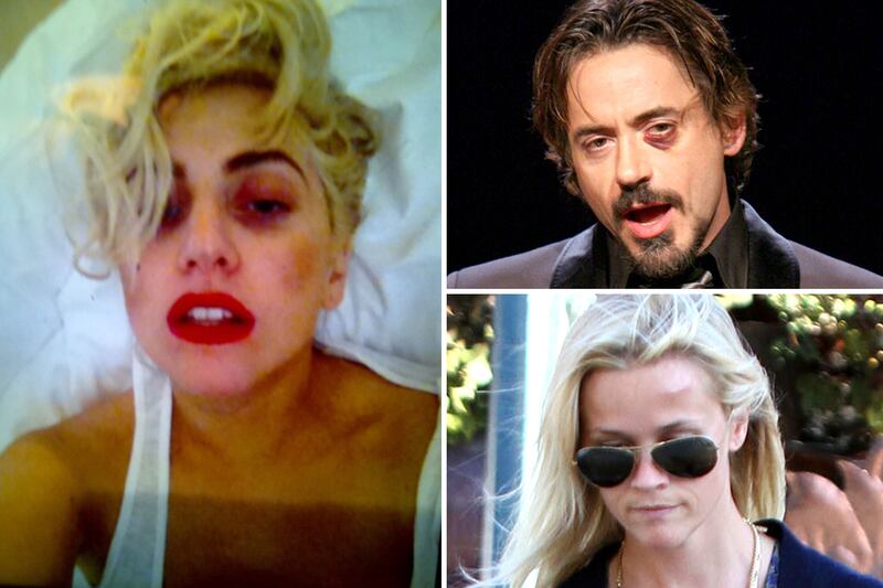 galleries/2012/06/13/stars-with-shiners-lady-gaga-reese-witherspoon-robert-downey-jr-madonna-others/stars-with-shiners-tease_hrjqua