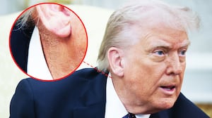 Donald Trump with an inset image of the rash and coverup on his neck