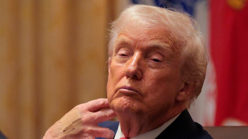 WASHINGTON, DC - DECEMBER 02: U.S. President Donald Trump looks on during a meeting of his Cabinet in the Cabinet Room of the White House on December 02, 2025 in Washington, DC. A bipartisan Congressional investigation has begun regarding Secretary of War Pete Hegseth's role in ordering U.S. military strikes on small boats in the waters off Venezuela that have killed scores of people, which Hegseth said are intended