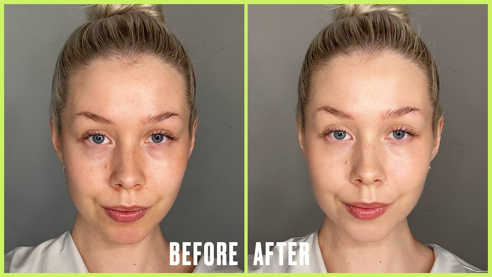 Before and After of Roosa Rahkonen using makeup to conceal veins.