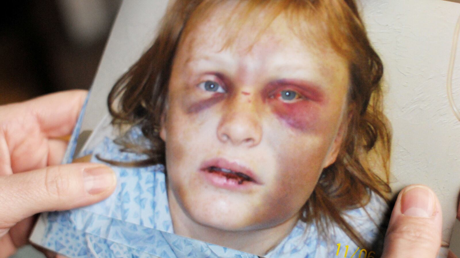 articles/2014/10/20/the-worst-question-for-abuse-victims/141019-shire-private-violence_tf3us4