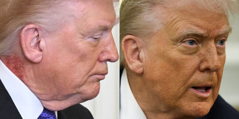 Donald Trump appeared noticeably oranger in the Oval Office on Tuesday (right) than the day prior (left). His neck rash, photographed on his right side on Monday, was also no longer visible.