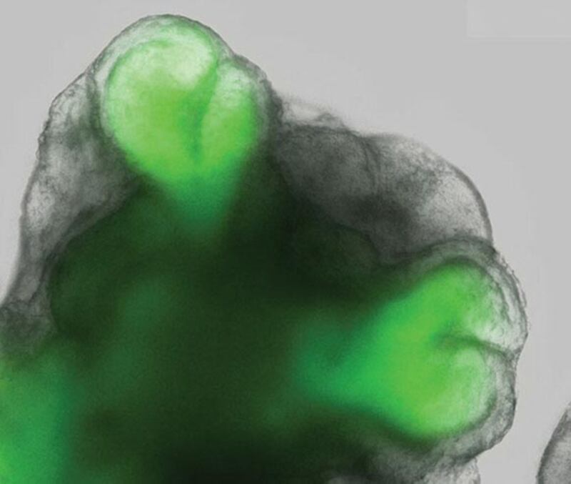 galleries/2011/12/26/scientific-advances-of-2011/scientific-advances-big-small-2011-gal-retna_jys8ez