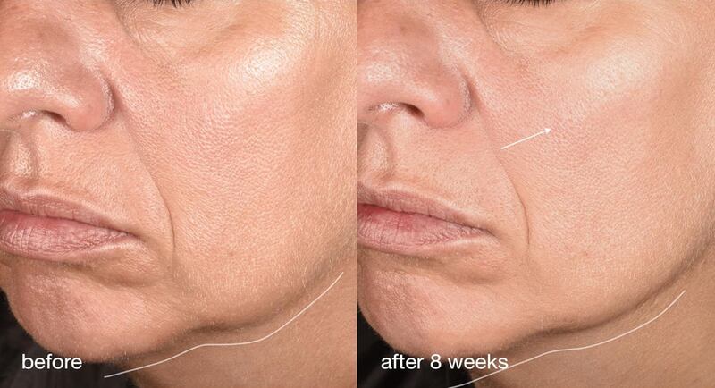 Dermalogica Neurotouch Symmetry Serum Before and After Review