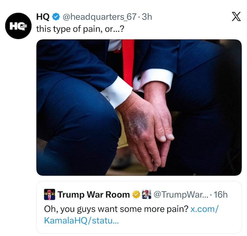 HQ
@headquarters_67
·
3h
this type of pain, or...?

Followed by a picture of Trump's bruised hands