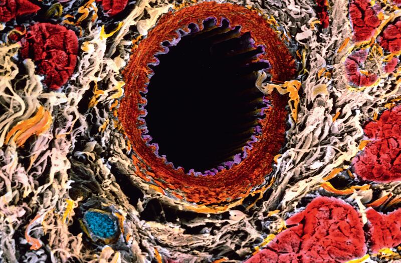 galleries/2015/02/02/a-way-too-close-look-at-the-human-body/150130-science-beautiful-cross-section-of-artery_wmhnyp