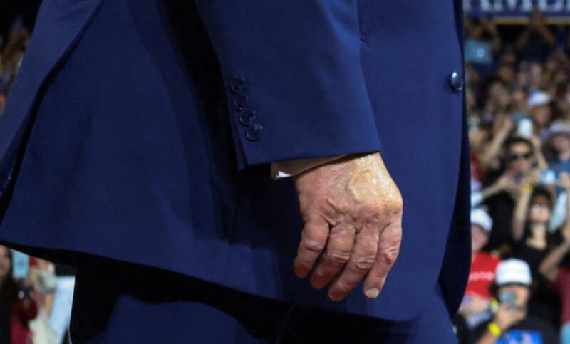 Close up of Trump's two hands.