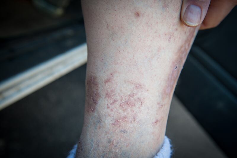 galleries/2014/03/02/the-west-virginia-river-no-one-can-drink-from-photos/140228-weastva-water19_tjrvrn