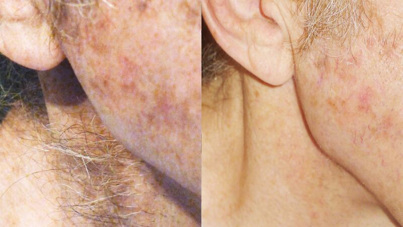 170803-Haden-Man-gets-waxed-for-the-first-time-embed2_usmi3h