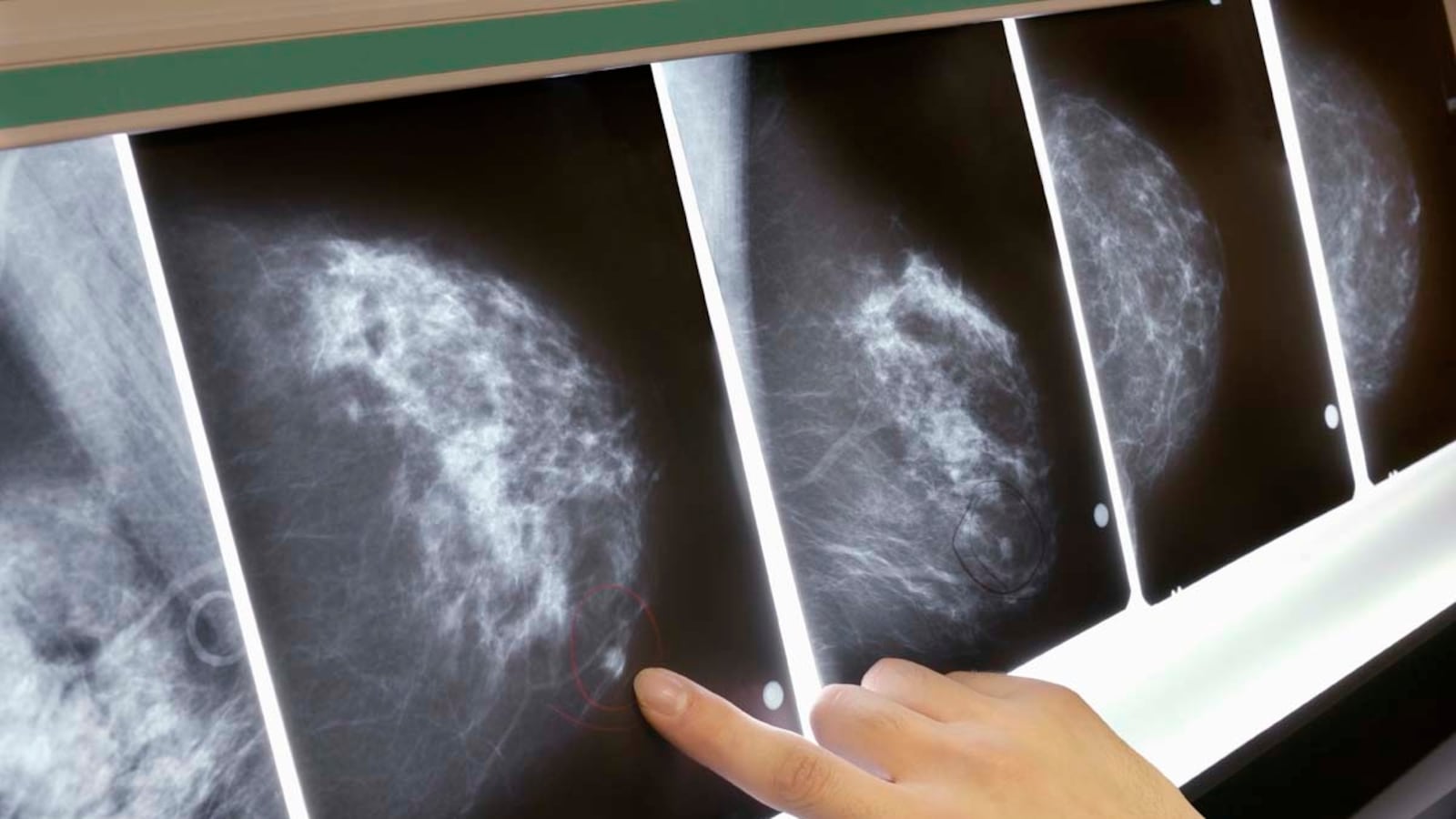 articles/2012/09/24/5-highlights-of-the-new-breast-cancer-study/breast-cancer-study-crocker_yl8rhu