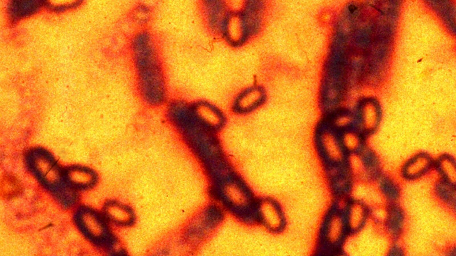 cheats/2015/05/27/u-s-accidentally-ships-live-anthrax/150527-anthrax-cheat_o8cjjr