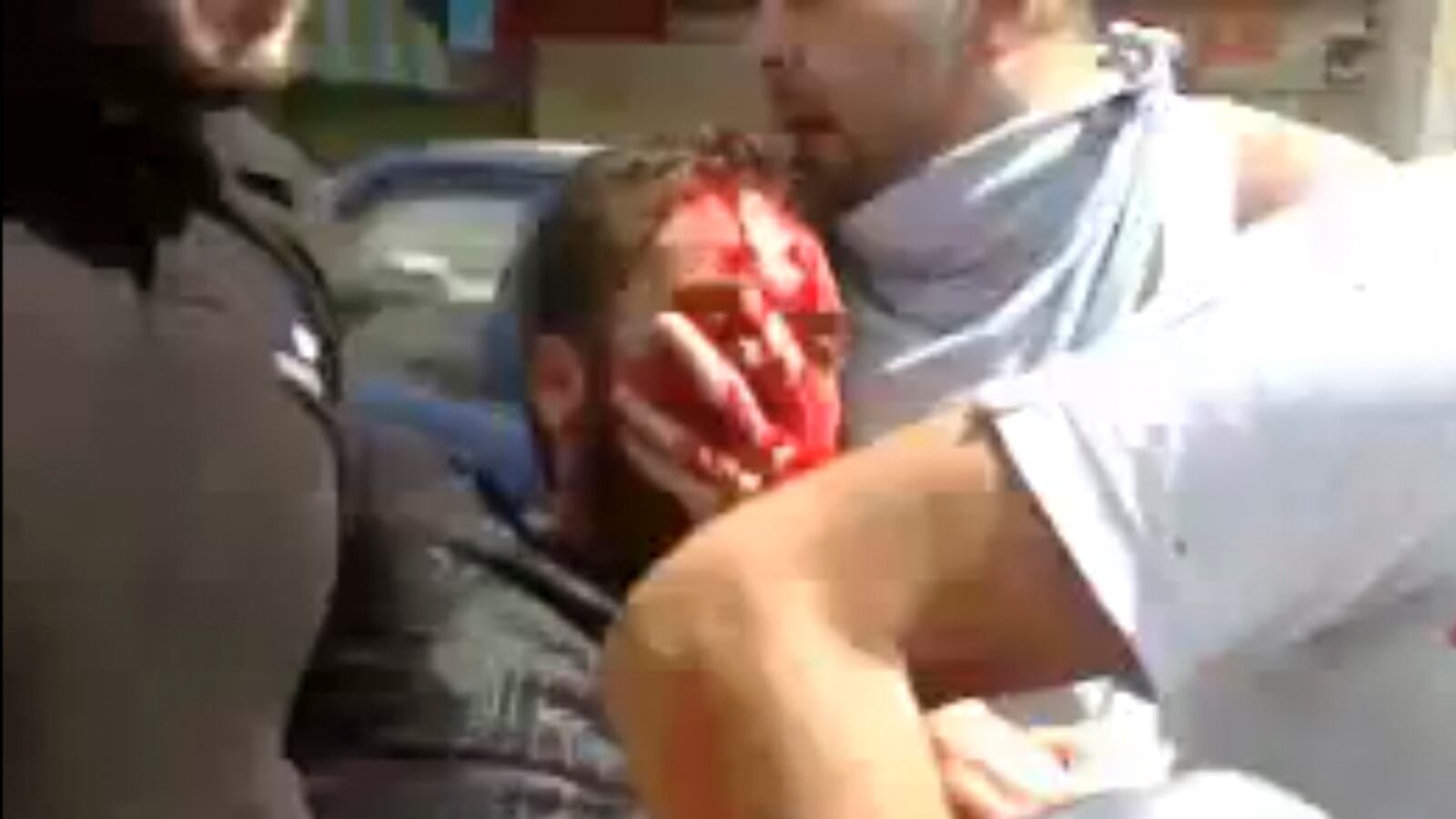 cheats/2011/08/30/syria-kills-seven-protesters/syria-injured-protestor-homs-cheat_xwzgnm
