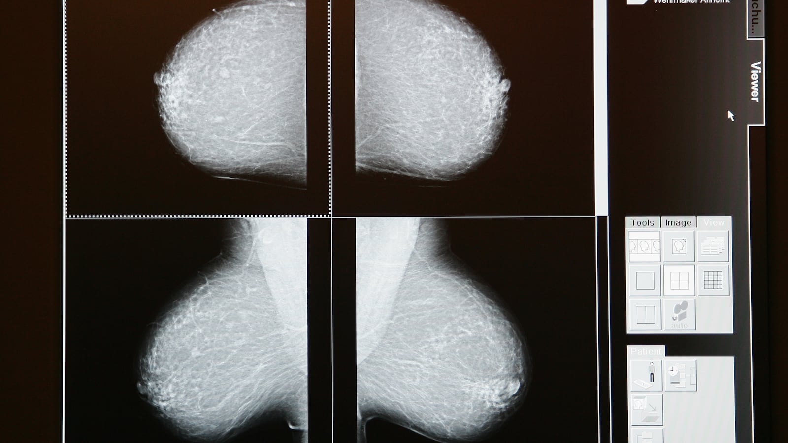 GettyImages-80558873_bp07q7