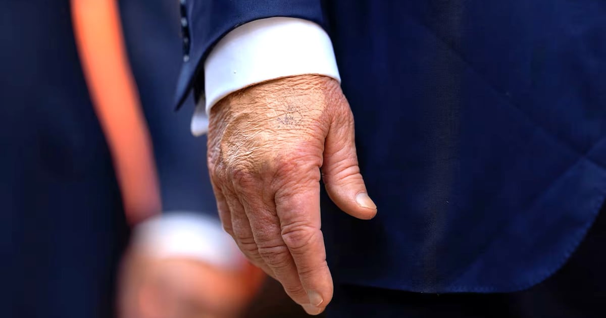 Trump’s Hand Makeup Is Back Days After Last Appearance Trump’s Hand Makeup Is Back Days After Last Appearance
