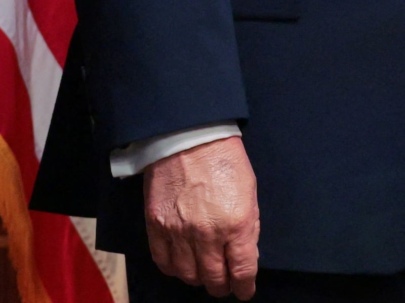 A close-up of Trump's right hand.