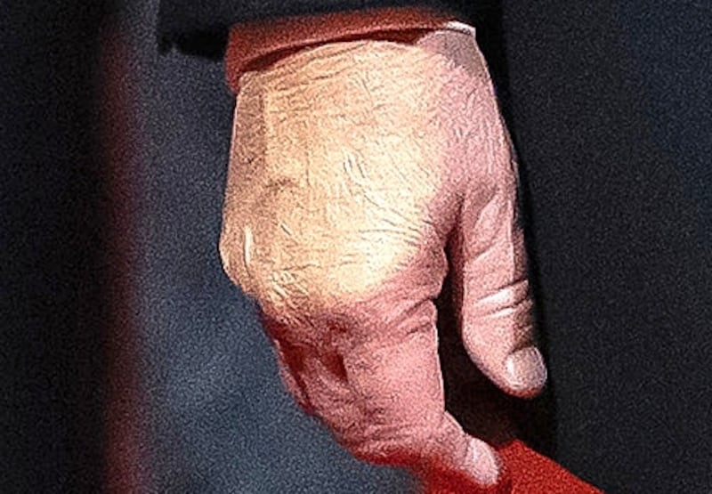 The make-up-slathered hand was visible at the state dinner.
