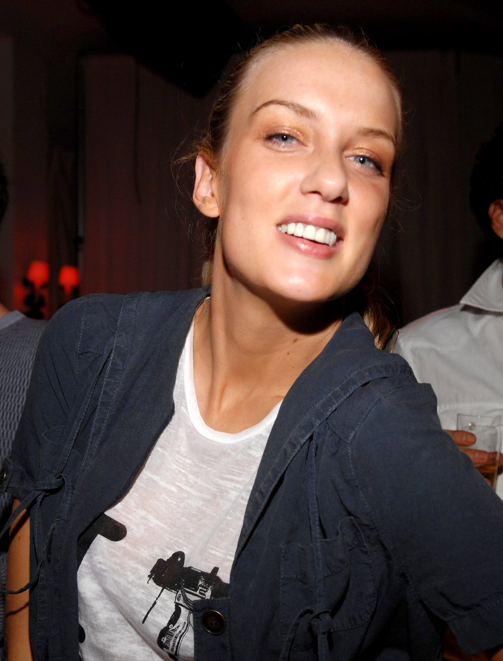 Sprague underwent surgery to remove four teeth and shave down others.