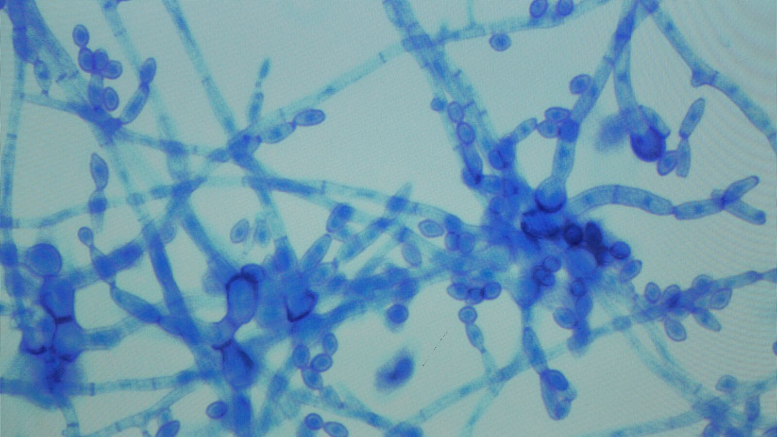 cheats/2012/10/20/meningitis-death-toll-hits-23/meninigitis-death-toll-cheat_jtx9zn