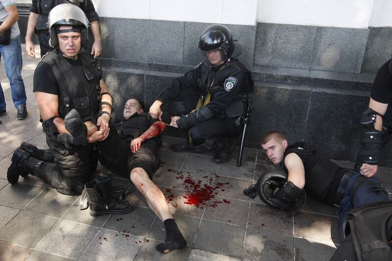 galleries/2015/08/31/protesters-clash-with-police-in-ukraine-photos/150831-ukraine-clashes3_vm20fj