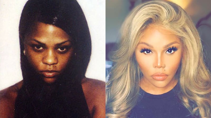 Lil’ Kim’s Lighter, Whiter Skin Is a Sad Indictment of Racism