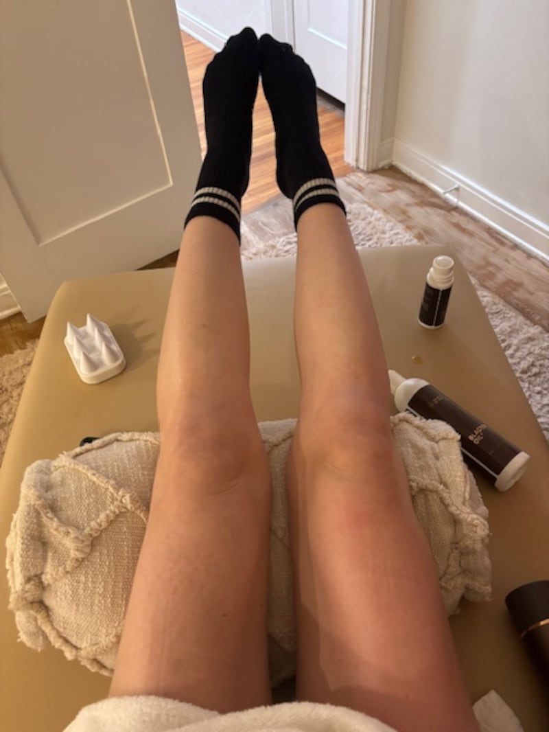 Fascia Blasting Before and After