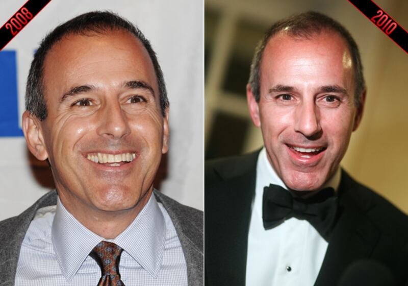 galleries/2010/12/29/reverse-aging/reverse-aging---lauer_pyskrq