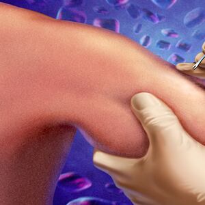 171201-Offit-Small-pox-vaccine-hero_t03gxe