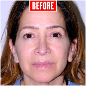 Eyebrow Tranformation