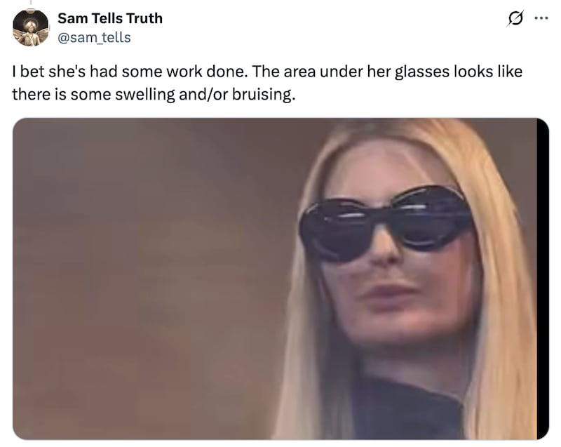 X user ponders if Ivanka got more surgery.