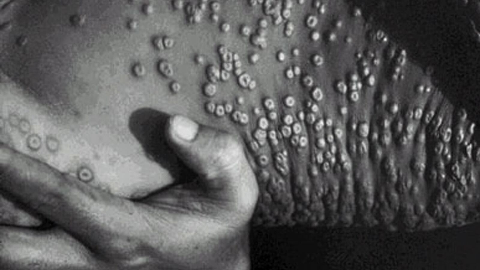 2001-10-19T120000Z_826081278_PBEAHUKWWDR_RTRMADP_3_SMALLPOX_vbgaxp