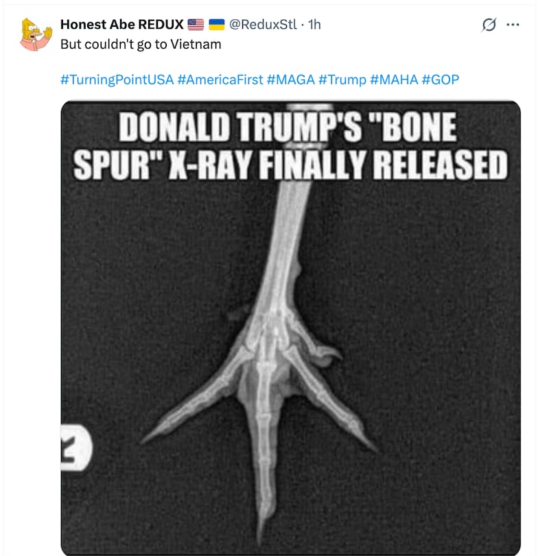 Trump's haunting chicken bone spurs.