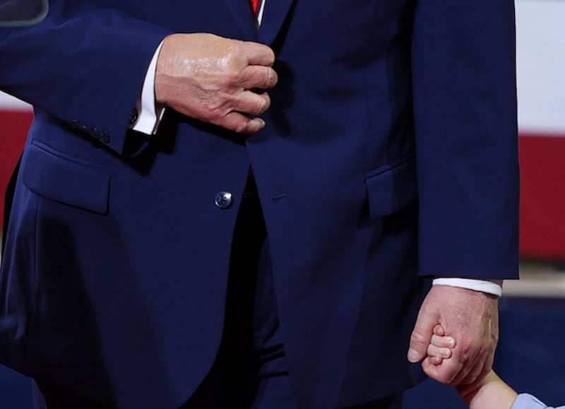 Close up of Trump's two hands.