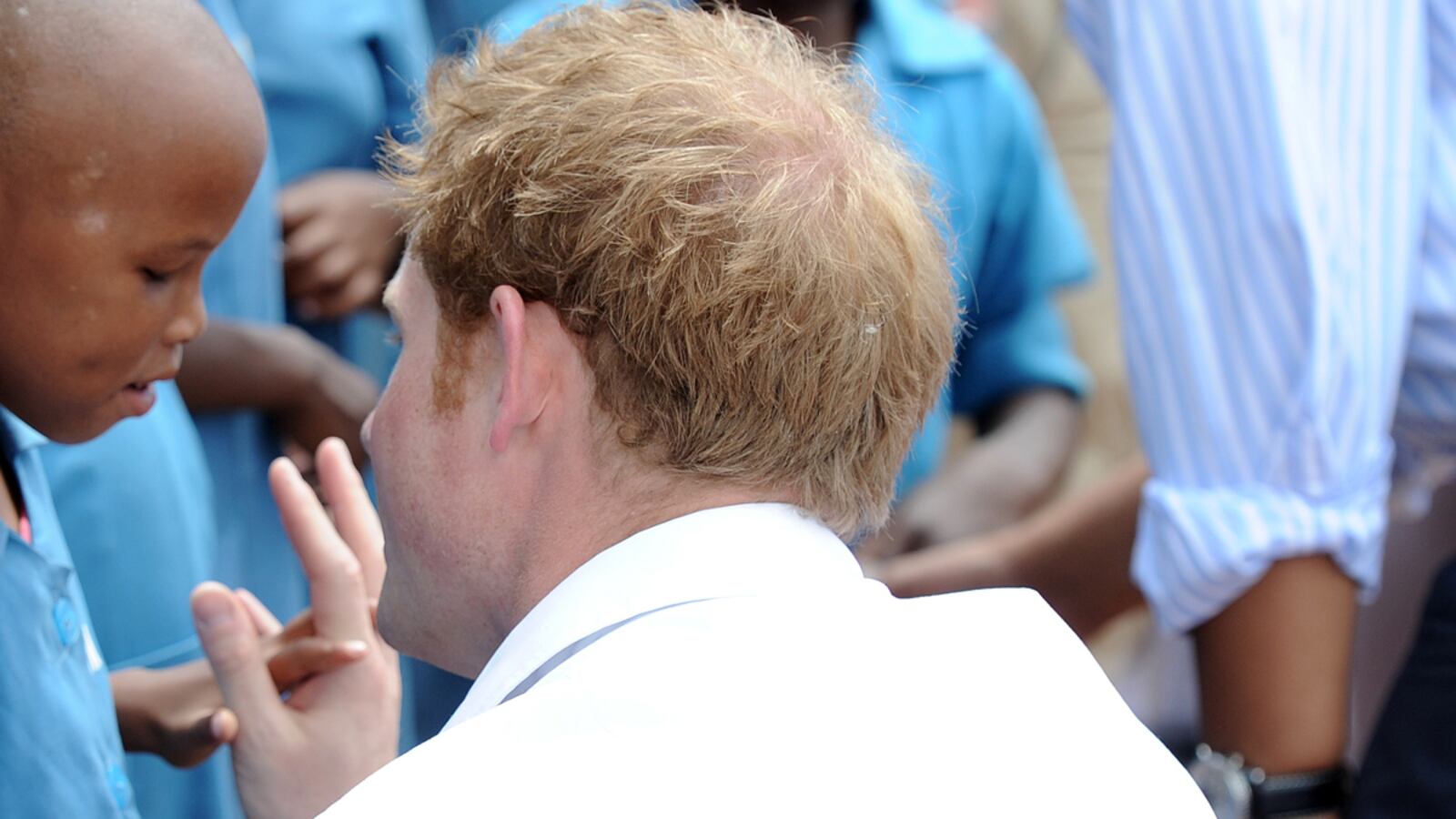 articles/2013/02/28/is-harry-going-bald/harry-bald_fdwfa0