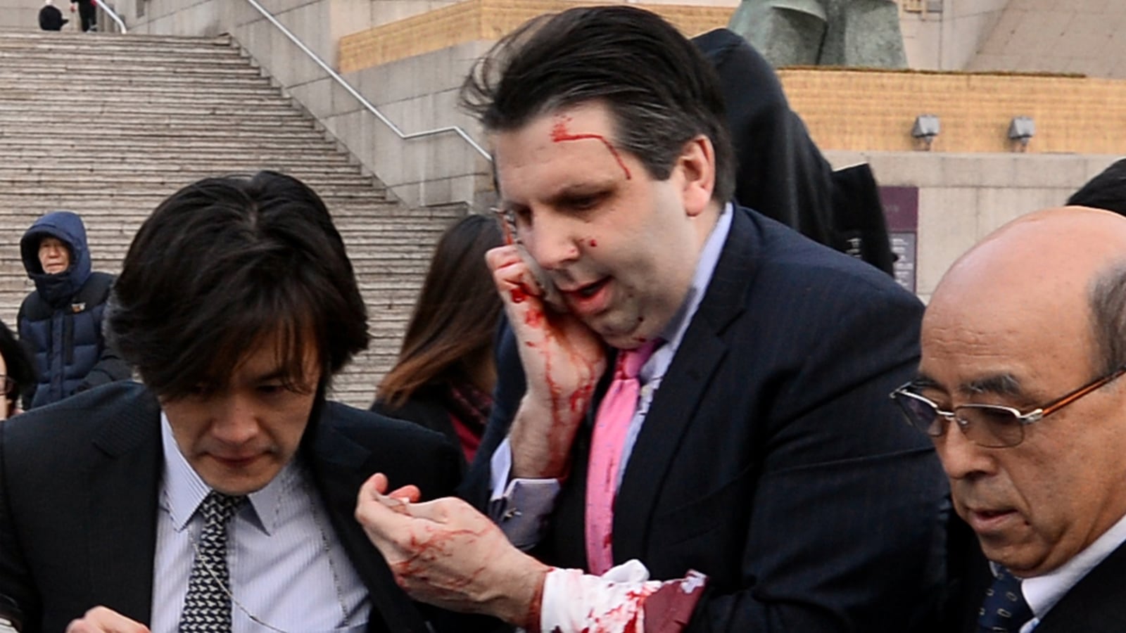 cheats/2015/03/10/s-korea-u-s-ambassador-out-of-hospital/150304-samuels-korea-embassador-tease_sbr6qa