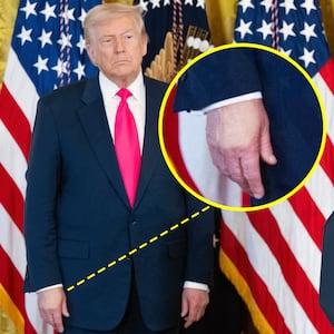 Donald Trump, his hand makeup, and Melania Trump.