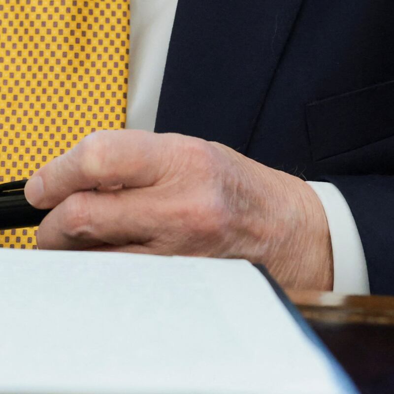 Donald Trump bruise hand left