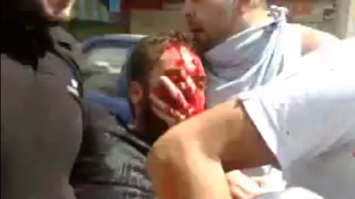 cheats/2011/09/02/injured-protesters-abused-in-hospitals/syria-injured-protestor-homs-cheat_rb9ksq