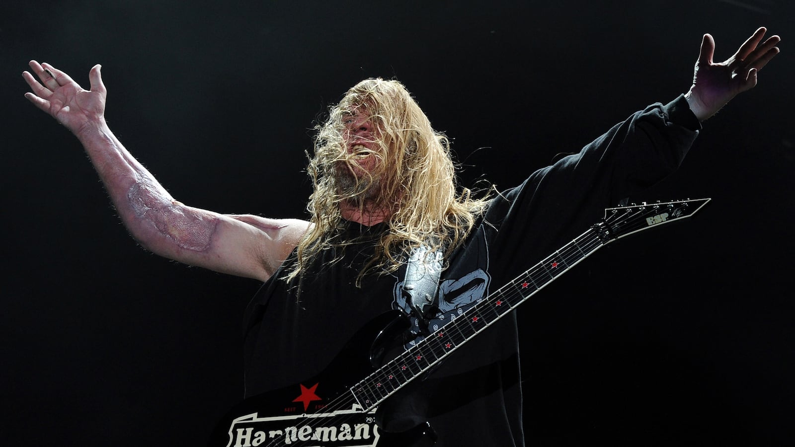 articles/2013/05/05/don-t-blame-spider-bite-for-felling-slayer-guitarist-jeff-hanneman/130504-sepkowitz-hanneman-tease-embed_l9vzqi