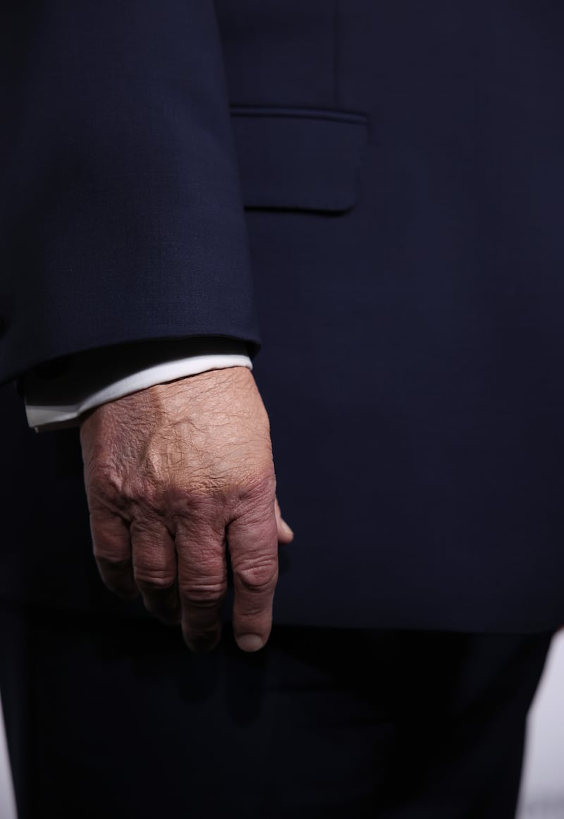 Makeup is visible on the hand of U.S. President Donald Trump as he attends a screening of the documentary film “Melania” at The Kennedy Center on January 29, 2026 in Washington, DC.