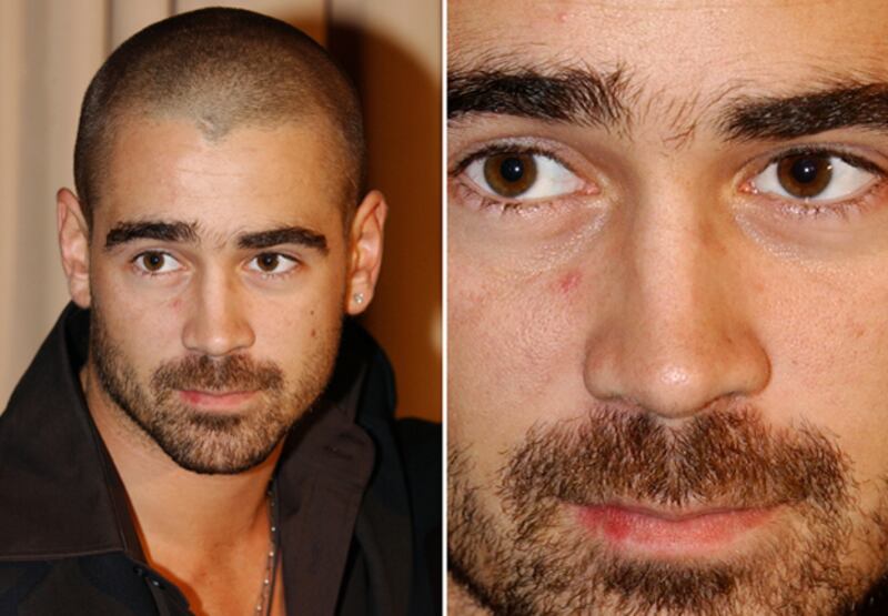 galleries/2010/01/19/wild-and-woolly-stars/hairy-celecolin-farrell_la97j3