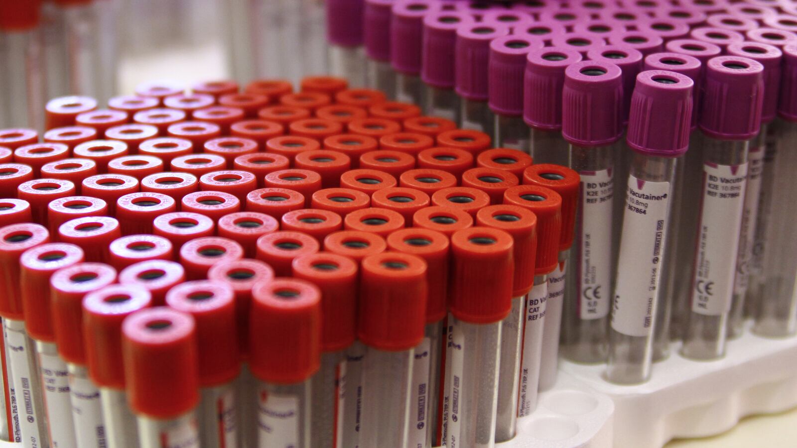 cheats/2013/03/11/alzheimer-s-test-may-detect-disease-sooner/130311-alzheimers-blood-test-cheat_rmzqsl