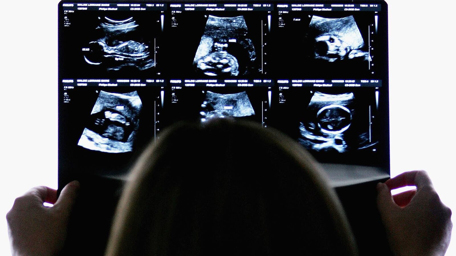 cheats/2014/04/16/judge-ends-n-dakota-abortion-law/140416-abortion-nd-cheat_jiqpbp