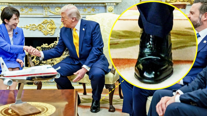 A photo composite of Donald Trump's cankles during the Japan prime minister's visit to the White House.