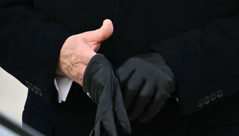 A close-up of the bruising on President Trump's right hand.