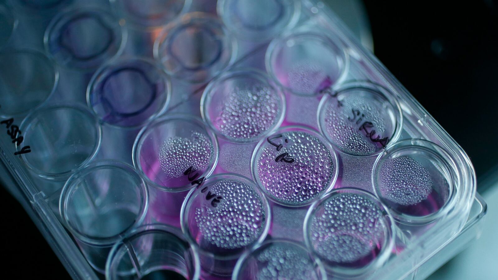 cheats/2017/02/28/study-colorectal-cancer-rates-rise-for-young-people/170228-cancer-cheat_gwfzth