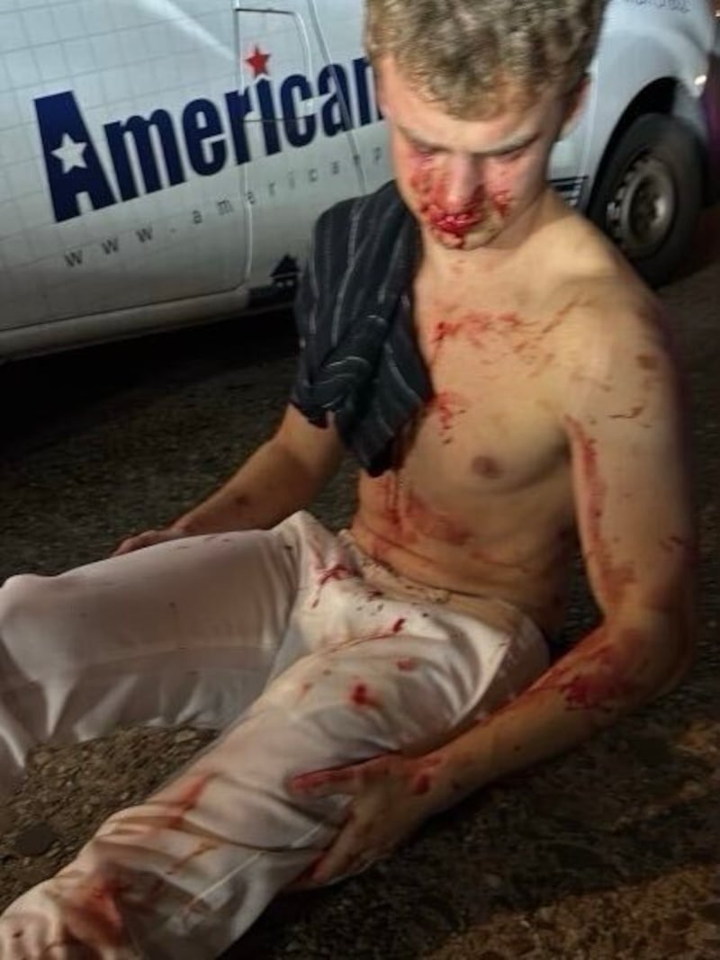a bloodied Edward Coristine sitting on ground after attack.