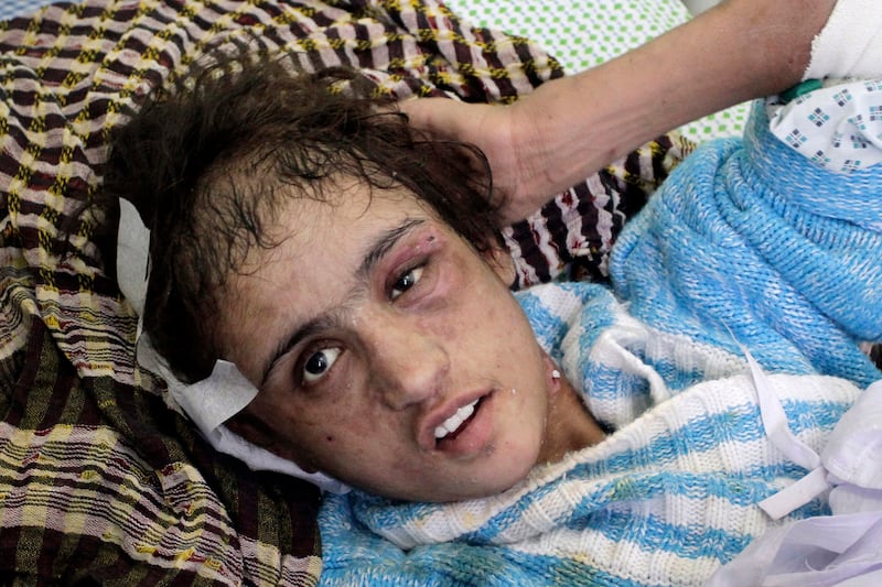 articles/2012/01/09/sahar-gul-torture-case-shows-limited-rights-perilous-lives-of-afghan-women/tortured-afghani-girl-lemmon_ywsvgz