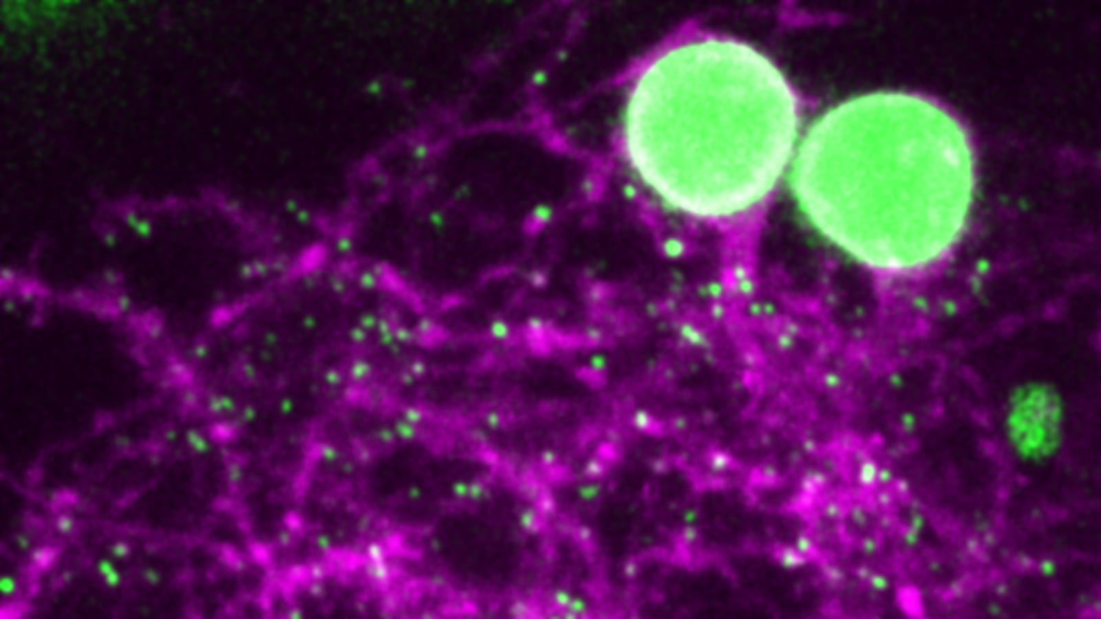 Low-Res_Image_2_-_dendrites_and_synapses.png_zs5ld2