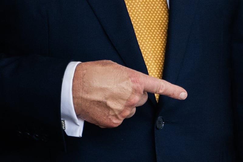 Donald Trump with makeup covering bruised hand.