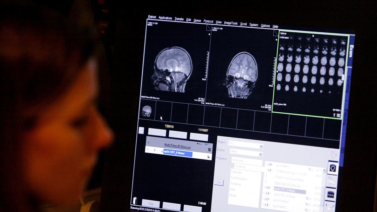 cheats/2011/08/15/study-autism-linked-to-siblings/autism-sibling-cheat_hnabif